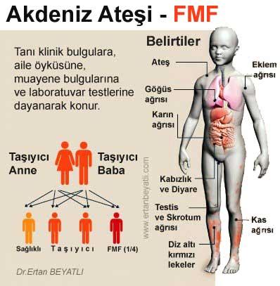 fmf hastalığı